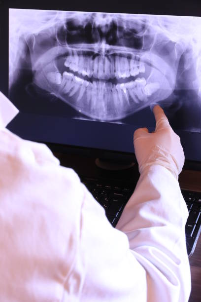 Best Emergency Root Canal Treatment in Platte, SD