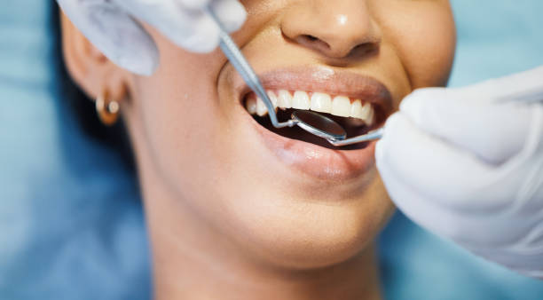 Best Emergency Dental Extractions in Platte, SD